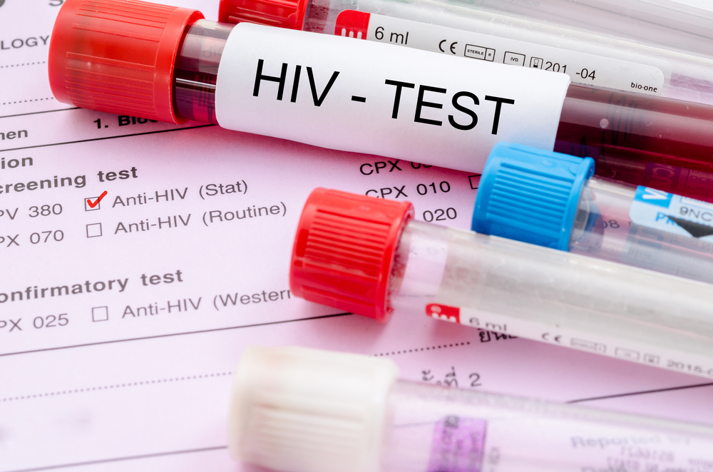 1000421955 Mayoritas LSL, 454 Kasus HIV/AIDS Ditemukan di Makassar